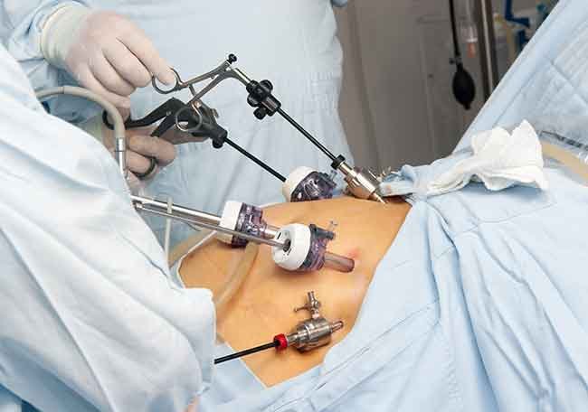 La cirugía de bypass gástrico hace que la diabetes tipo 2 entre en remisión
